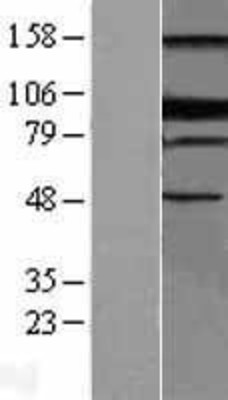 Western Blot: Blimp-1 Overexpression Lysate (Adult Normal) [NBL1-14733] Left-Empty vector transfected control cell lysate (HEK293 cell lysate); Right -Over-expression Lysate for Blimp-1.