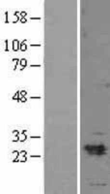 Western Blot: Myosin light chain 3 Overexpression Lysate (Adult Normal) [NBL1-13425] Left-Empty vector transfected control cell lysate (HEK293 cell lysate); Right -Over-expression Lysate for Myosin light chain 3.