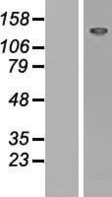 Western Blot: L1CAM Overexpression Lysate (Adult Normal) [NBL1-12417] Left-Empty vector transfected control cell lysate (HEK293 cell lysate); Right -Over-expression Lysate for L1CAM.