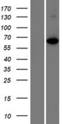 Western Blot: Shugoshin Overexpression Lysate (Adult Normal) [NBP2-11017] Left-Empty vector transfected control cell lysate (HEK293 cell lysate); Right -Over-expression Lysate for Shugoshin.