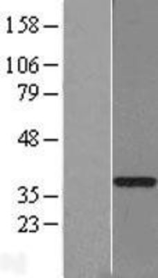 Western Blot: GTF2H3 Overexpression Lysate (Adult Normal) [NBL1-11390] Left-Empty vector transfected control cell lysate (HEK293 cell lysate); Right -Over-expression Lysate for GTF2H3.