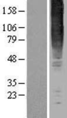 Western Blot: GPR83 Overexpression Lysate (Adult Normal) [NBL1-11296] Left-Empty vector transfected control cell lysate (HEK293 cell lysate); Right -Over-expression Lysate for GPR83.