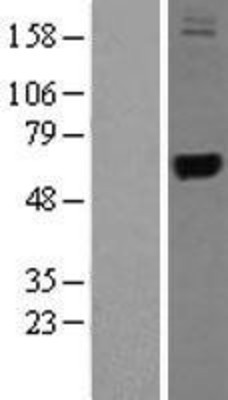 Western Blot: TRMT1 Overexpression Lysate (Adult Normal) [NBL1-17326] Left-Empty vector transfected control cell lysate (HEK293 cell lysate); Right -Over-expression Lysate for TRMT1.