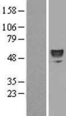 Western Blot: ERO1LB Overexpression Lysate (Adult Normal) [NBL1-10336] Left-Empty vector transfected control cell lysate (HEK293 cell lysate); Right -Over-expression Lysate for ERO1LB.