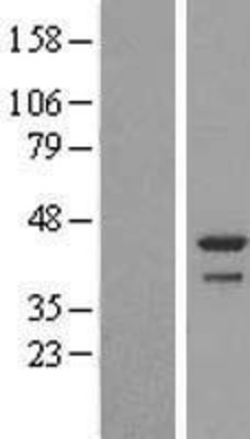 Western Blot: DDRGK1 Overexpression Lysate (Adult Normal) [NBL1-08360] Left-Empty vector transfected control cell lysate (HEK293 cell lysate); Right -Over-expression Lysate for DDRGK1.