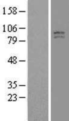 Western Blot: TCIRG1 Overexpression Lysate (Adult Normal) [NBL1-16779] Left-Empty vector transfected control cell lysate (HEK293 cell lysate); Right -Over-expression Lysate for TCIRG1.