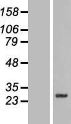 Western Blot: SLC39A3 Overexpression Lysate (Adult Normal) [NBL1-16146] Left-Empty vector transfected control cell lysate (HEK293 cell lysate); Right -Over-expression Lysate for SLC39A3.