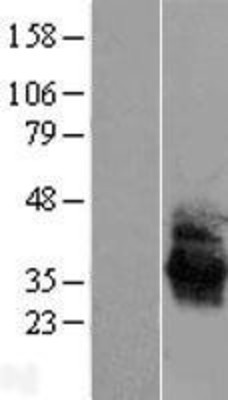 Western Blot: Angiotensin II Type 1 Receptor Overexpression Lysate (Adult Normal) [NBL1-07395] Left-Empty vector transfected control cell lysate (HEK293 cell lysate); Right -Over-expression Lysate for Angiotensin II Type 1 Receptor.