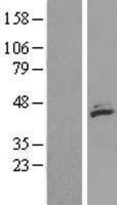 Western Blot: MECR Overexpression Lysate (Adult Normal) [NBL1-12978] Left-Empty vector transfected control cell lysate (HEK293 cell lysate); Right -Over-expression Lysate for MECR.