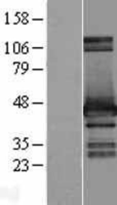 Western Blot: HOMER2 Overexpression Lysate (Adult Normal) [NBL1-11656] Left-Empty vector transfected control cell lysate (HEK293 cell lysate); Right -Over-expression Lysate for HOMER2.