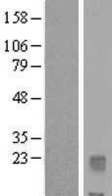 Western Blot: IL32 Overexpression Lysate (Adult Normal) [NBL1-11953] Left-Empty vector transfected control cell lysate (HEK293 cell lysate); Right -Over-expression Lysate for IL32.