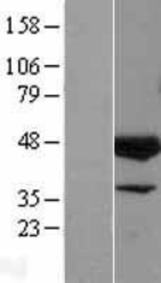 Western Blot: ELK3 Overexpression Lysate (Adult Normal) [NBL1-10233] Left-Empty vector transfected control cell lysate (HEK293 cell lysate); Right -Over-expression Lysate for ELK3.