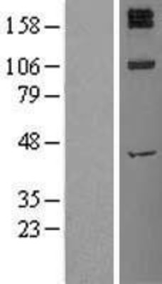 Western Blot: Insulin Receptor Overexpression Lysate (Adult Normal) [NBL1-12008] Left-Empty vector transfected control cell lysate (HEK293 cell lysate); Right -Over-expression Lysate for Insulin Receptor.