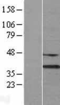 Western Blot: DNASE1L3 Overexpression Lysate (Adult Normal) [NBL1-09963] Left-Empty vector transfected control cell lysate (HEK293 cell lysate); Right -Over-expression Lysate for DNASE1L3.