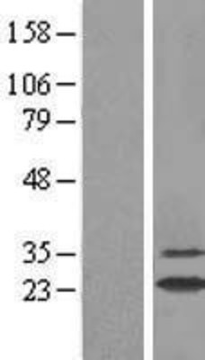 Western Blot: GSTA2 Overexpression Lysate (Adult Normal) [NBL1-11367] Left-Empty vector transfected control cell lysate (HEK293 cell lysate); Right -Over-expression Lysate for GSTA2.