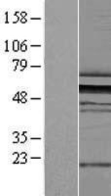 Western Blot: ZNF259 Overexpression Lysate (Adult Normal) [NBL1-18102] Left-Empty vector transfected control cell lysate (HEK293 cell lysate); Right -Over-expression Lysate for ZNF259.