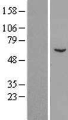 Western Blot: RGS7 Overexpression Lysate (Adult Normal) [NBL1-15337] Left-Empty vector transfected control cell lysate (HEK293 cell lysate); Right -Over-expression Lysate for RGS7.
