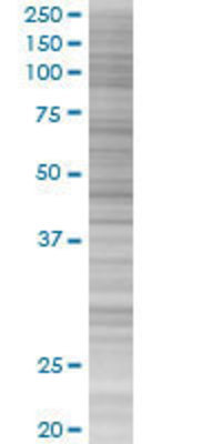 YBX2 transfected lysate.