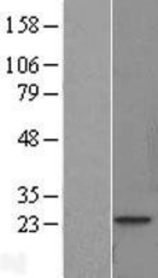 Western Blot: Troponin I Type 1 (slow skeletal) Overexpression Lysate (Adult Normal) [NBL1-17178] Left-Empty vector transfected control cell lysate (HEK293 cell lysate); Right -Over-expression Lysate for Troponin I Type 1 (slow skeletal).