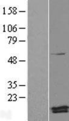 Western Blot: Magmas Overexpression Lysate (Adult Normal) [NBL1-12822] Left-Empty vector transfected control cell lysate (HEK293 cell lysate); Right -Over-expression Lysate for Magmas.