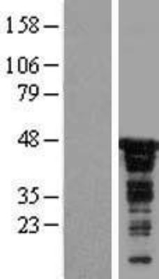 Western Blot: CDC37 Overexpression Lysate (Adult Normal) [NBL1-09002] Left-Empty vector transfected control cell lysate (HEK293 cell lysate); Right -Over-expression Lysate for CDC37.