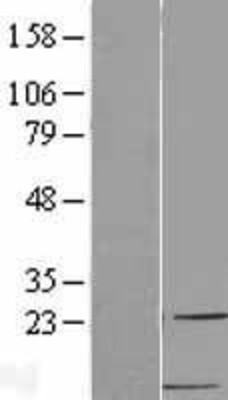 Western Blot: MDC Overexpression Lysate (Adult Normal) [NBL1-08852] Left-Empty vector transfected control cell lysate (HEK293 cell lysate); Right -Over-expression Lysate for MDC.