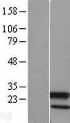 Western Blot: ATG12 Overexpression Lysate (Adult Normal) [NBL1-07795] Left-Empty vector transfected control cell lysate (HEK293 cell lysate); Right -Over-expression Lysate for ATG12.
