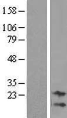 Western Blot: NRK1 Overexpression Lysate (Adult Normal) [NBL1-08607] Left-Empty vector transfected control cell lysate (HEK293 cell lysate); Right -Over-expression Lysate for NRK1.