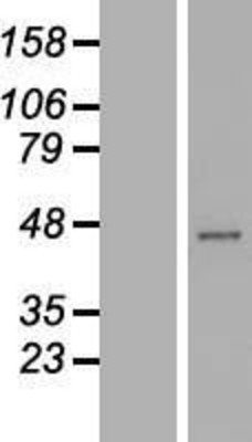 Western Blot: RRAGC Overexpression Lysate (Adult Normal) [NBL1-15587] Left-Empty vector transfected control cell lysate (HEK293 cell lysate); Right -Over-expression Lysate for RRAGC.