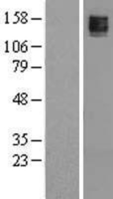 Western Blot: Maxi Potassium channel alpha Overexpression Lysate (Adult Normal) [NBL1-12189] Left-Empty vector transfected control cell lysate (HEK293 cell lysate); Right -Over-expression Lysate for Maxi Potassium channel alpha.