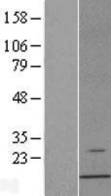 Western Blot: ERAF Overexpression Lysate (Adult Normal) [NBL1-10308] Left-Empty vector transfected control cell lysate (HEK293 cell lysate); Right -Over-expression Lysate for ERAF.