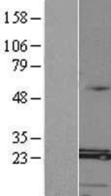 Western Blot: MED8 Overexpression Lysate (Adult Normal) [NBL1-12995] Left-Empty vector transfected control cell lysate (HEK293 cell lysate); Right -Over-expression Lysate for MED8.