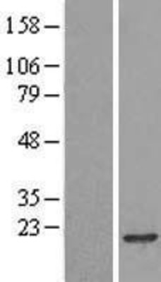 Western Blot: RPB8 Overexpression Lysate (Adult Normal) [NBL1-14585] Left-Empty vector transfected control cell lysate (HEK293 cell lysate); Right -Over-expression Lysate for RPB8.