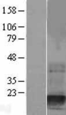 Western Blot: Destrin Overexpression Lysate (Adult Normal) [NBL1-10028] Left-Empty vector transfected control cell lysate (HEK293 cell lysate); Right -Over-expression Lysate for Destrin.