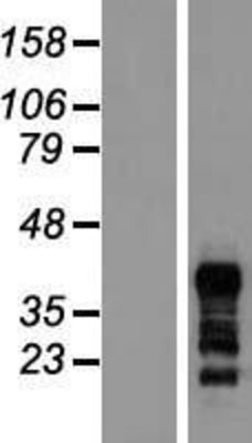 Western Blot: RNF126 Overexpression Lysate (Adult Normal) [NBL1-15417] Left-Empty vector transfected control cell lysate (HEK293 cell lysate); Right -Over-expression Lysate for RNF126.