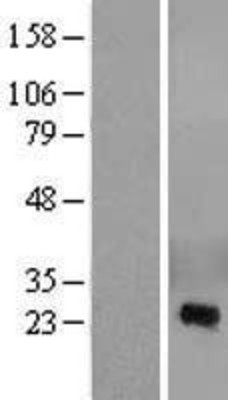 Western Blot: CRISP2 Overexpression Lysate (Adult Normal) [NBL1-09480] Left-Empty vector transfected control cell lysate (HEK293 cell lysate); Right -Over-expression Lysate for CRISP2.