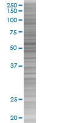 TXNRD1 transfected lysate.