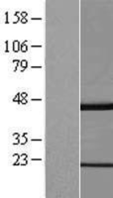 Western Blot: GKAP1 Overexpression Lysate (Adult Normal) [NBL1-11102] Left-Empty vector transfected control cell lysate (HEK293 cell lysate); Right -Over-expression Lysate for GKAP1.