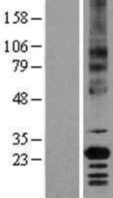 Western Blot: CD147 Overexpression Lysate (Adult Normal) [NBL1-08036] Left-Empty vector transfected control cell lysate (HEK293 cell lysate); Right -Over-expression Lysate for CD147.