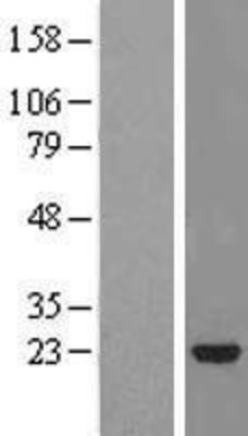 Western Blot: STARD5 Overexpression Lysate (Adult Normal) [NBL1-16520] Left-Empty vector transfected control cell lysate (HEK293 cell lysate); Right -Over-expression Lysate for STARD5.
