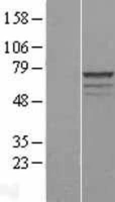 Western Blot: MPP3 Overexpression Lysate (Adult Normal) [NBL1-13204] Left-Empty vector transfected control cell lysate (HEK293 cell lysate); Right -Over-expression Lysate for MPP3.