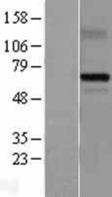 Western Blot: MDMX Overexpression Lysate (Adult Normal) [NBL1-12971] Left-Empty vector transfected control cell lysate (HEK293 cell lysate); Right -Over-expression Lysate for MDMX.