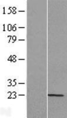 Western Blot: TNFAIP8L2 Overexpression Lysate (Adult Normal) [NBL1-17140] Left-Empty vector transfected control cell lysate (HEK293 cell lysate); Right -Over-expression Lysate for TNFAIP8L2.