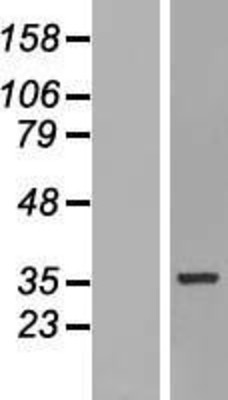 Western Blot: HNRPH3 Overexpression Lysate (Adult Normal) [NBP2-11294] Left-Empty vector transfected control cell lysate (HEK293 cell lysate); Right -Over-expression Lysate for HNRPH3.
