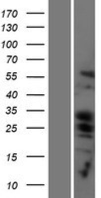 Western Blot: PUMA Overexpression Lysate (Adult Normal) [NBP2-11377] Left-Empty vector transfected control cell lysate (HEK293 cell lysate); Right -Over-expression Lysate for PUMA.