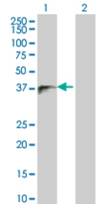 Lane 1: ITM2B transfected lysate (29.26 KDa) Lane 2: Non-transfected lysate.