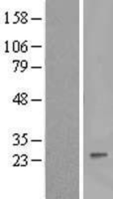 Western Blot: Interferon alpha 8 Overexpression Lysate (Adult Normal) [NBL1-11846] Left-Empty vector transfected control cell lysate (HEK293 cell lysate); Right -Over-expression Lysate for Interferon alpha 8.