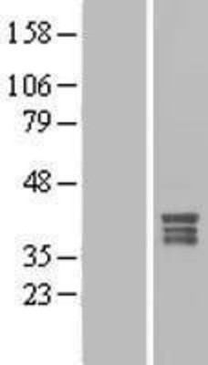 Western Blot: MPPED1 Overexpression Lysate (Adult Normal) [NBL1-13207] Left-Empty vector transfected control cell lysate (HEK293 cell lysate); Right -Over-expression Lysate for MPPED1.