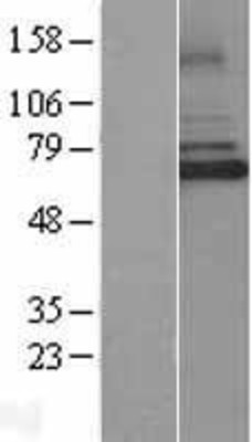 Western Blot: IRAK3 Overexpression Lysate (Adult Normal) [NBL1-12027] Left-Empty vector transfected control cell lysate (HEK293 cell lysate); Right -Over-expression Lysate for IRAK3.