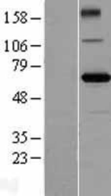 Western Blot: ZBTB2 Overexpression Lysate (Adult Normal) [NBL1-17964] Left-Empty vector transfected control cell lysate (HEK293 cell lysate); Right -Over-expression Lysate for ZBTB2.